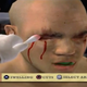 Illustration for article titled A Pro Fighters Best Friend Is The Guy Who Stops The Bleeding